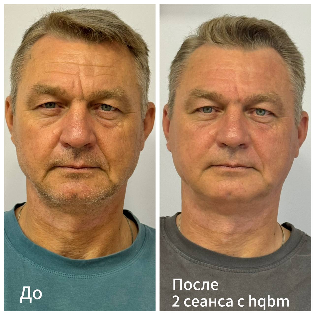 изображения